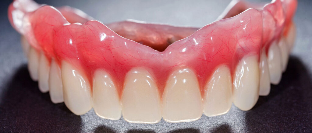Partial and Complete Dentures