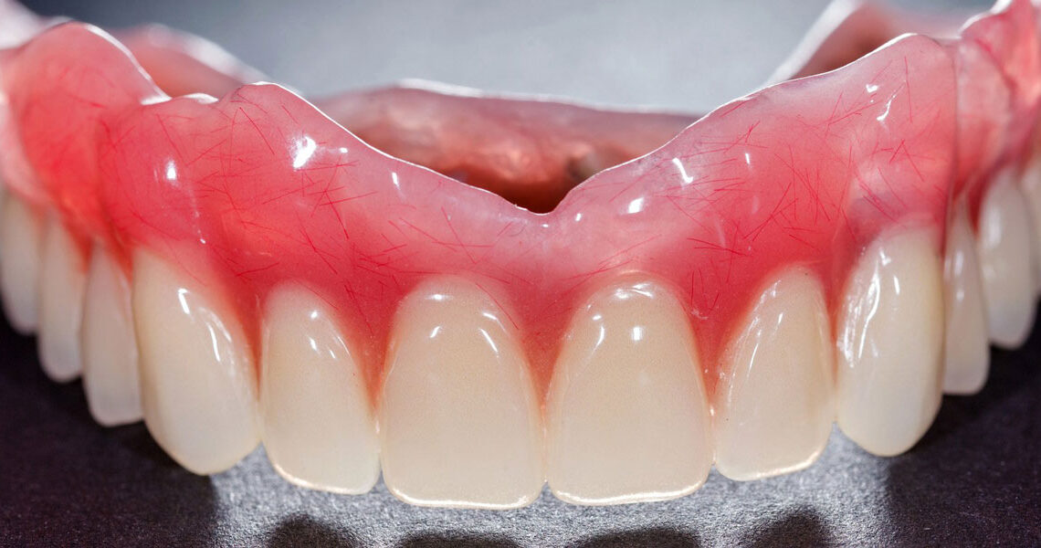 Partial and Complete Dentures